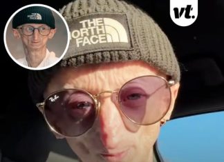 Influencer with rare disorder that causes rapid aging dies at 28