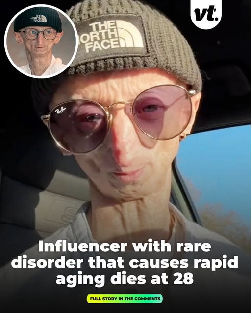 age