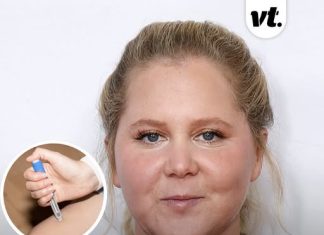 Amy Schumer shares unfiltered bikini pics after more than a year on Mounjaro