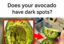Does your avocado have dark spots? Don’t throw it away! Here’s why