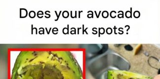 Does your avocado have dark spots? Don’t throw it away! Here’s why