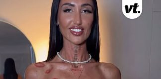 Australian influencer who underwent controversial Bali ‘Barbie Waist’ surgery shares what she used to look like