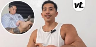 Man with 20lb hands reveals the one thing strangers always get wrong about his girlfriend