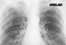 Scientists finally discover why some smokers are more likely to get cancer than others