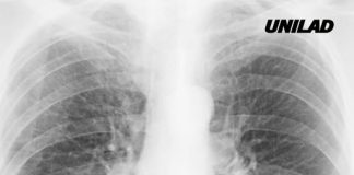 Scientists finally discover why some smokers are more likely to get cancer than others