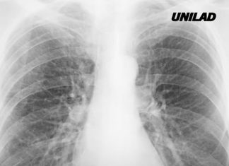 Scientists finally discover why some smokers are more likely to get cancer than others