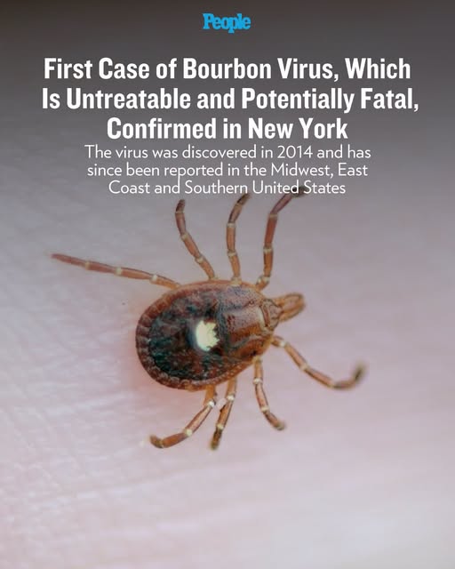 virus